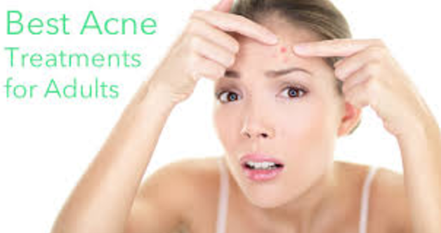 acne treatment